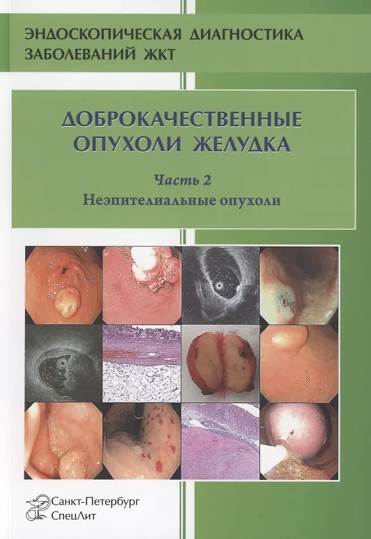 Книга Доброкачественные опухоли желудка. Часть 2 Неэпителиальные опухоли (Любовь Шкалова, Михаил Кузин, Виктор Добронец, Вячеслав Радовский) — 1