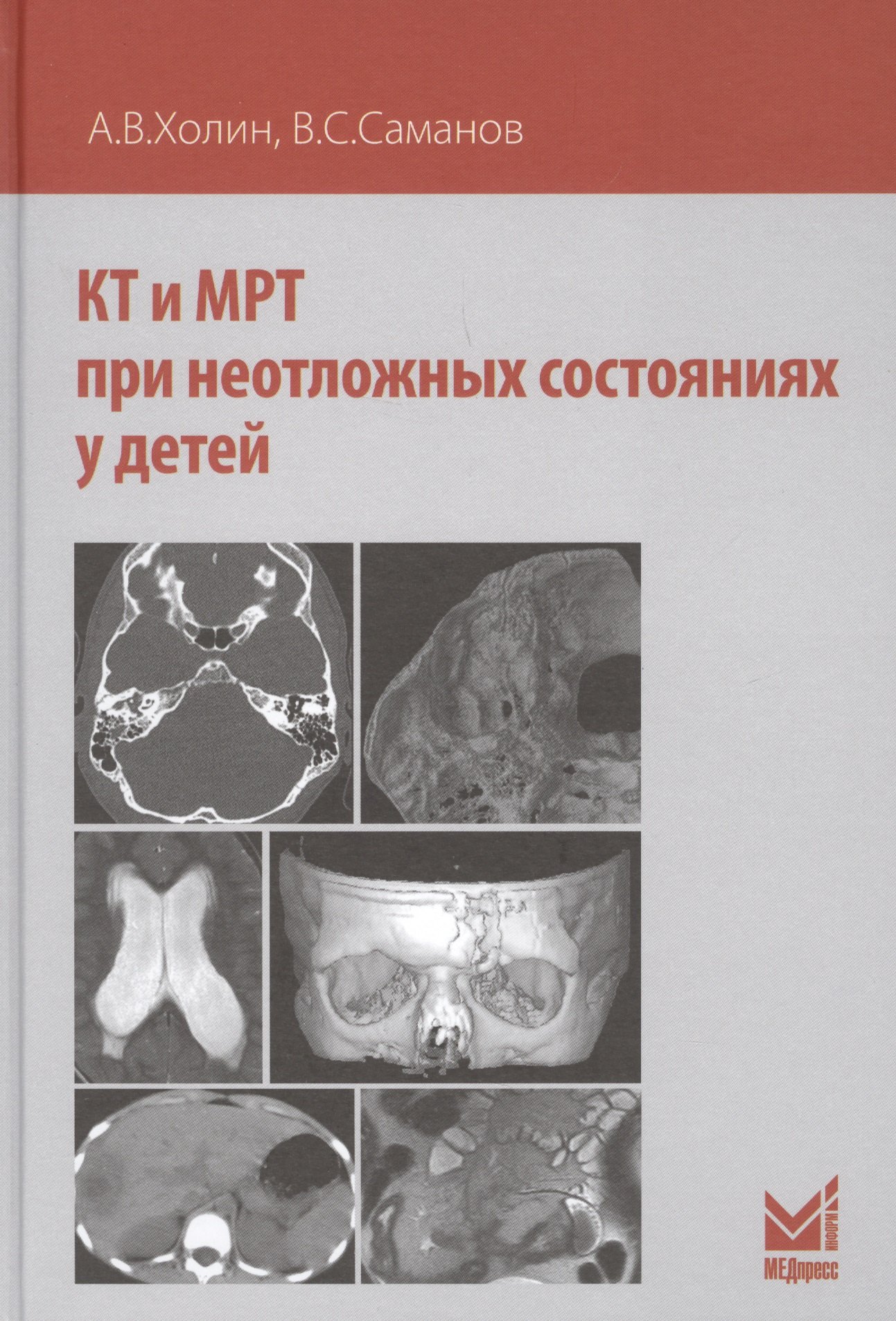 

КТ и МРТ при неотложных состояниях у детей