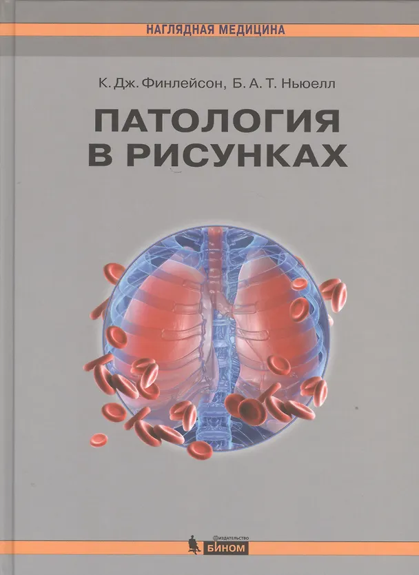 Книга Патология в рисунках (К. Финлейсон) — 1