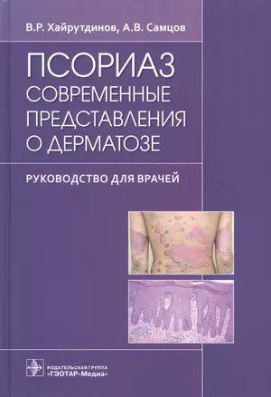 Псориаз. Современные представления о дерматозе. Руководство для врачей. — 2865531 — 1