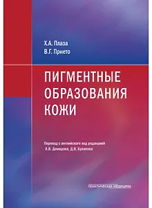 Пигментные образования кожи