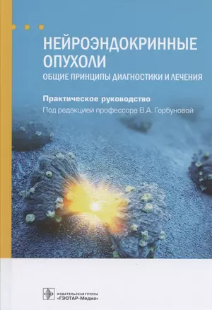 Нейроэндокринные опухоли. Общие принципы диагностики и лечения. Практическое руководство — 2838464 — 1