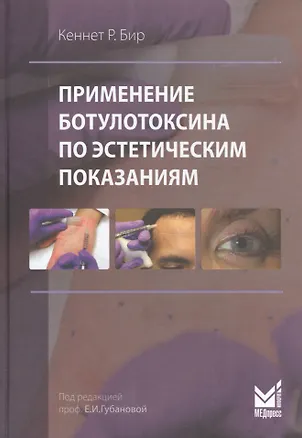 Книга Применение ботулотоксина по эстетическим показаниям (Кеннет Р. Бир)