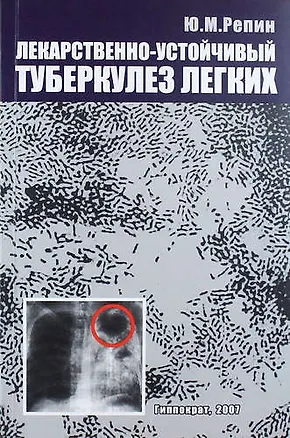 Книга Лекарственно-устойчивый  туберкулез легких: хирургическое лечение ()