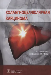 Холангиоцеллюлярная карцинома