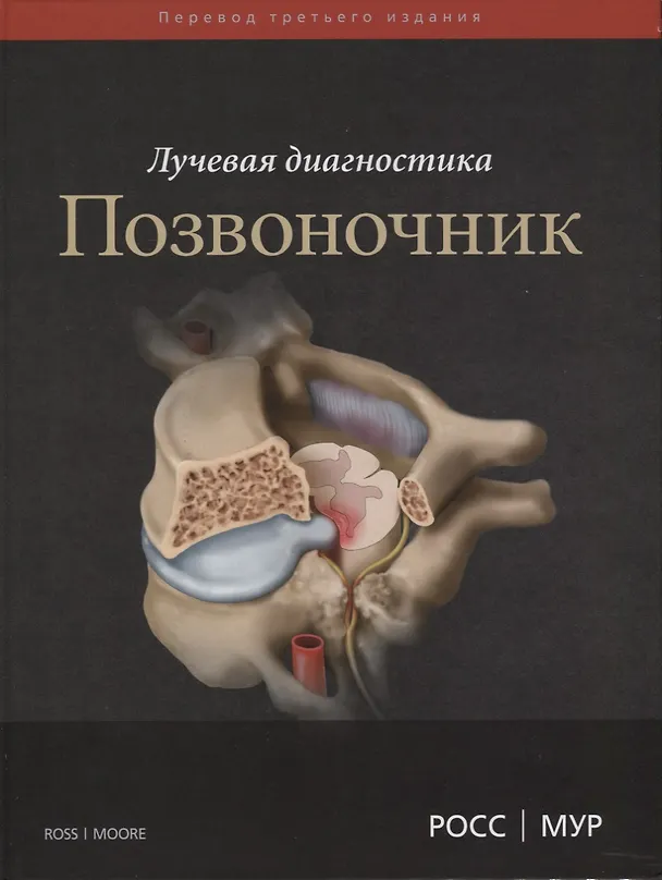 Книга Лучевая диагностика. Позвоночник (Джеффри Росс) — 1