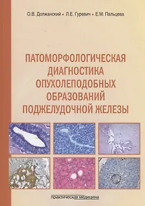 Патоморфологическая диагностика опухолеподобных образований поджелудочной железы. Руководство для врачей