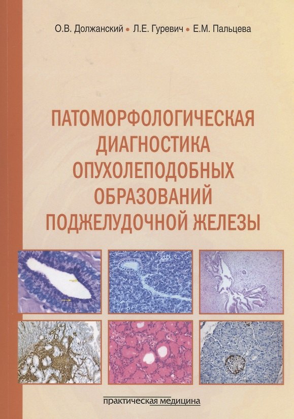 Книга Патоморфологическая диагностика опухолеподобных образований поджелудочной железы. Руководство для врачей (Екатерина Пальцева, Олег Должанский, Лариса Гуревич) — 1