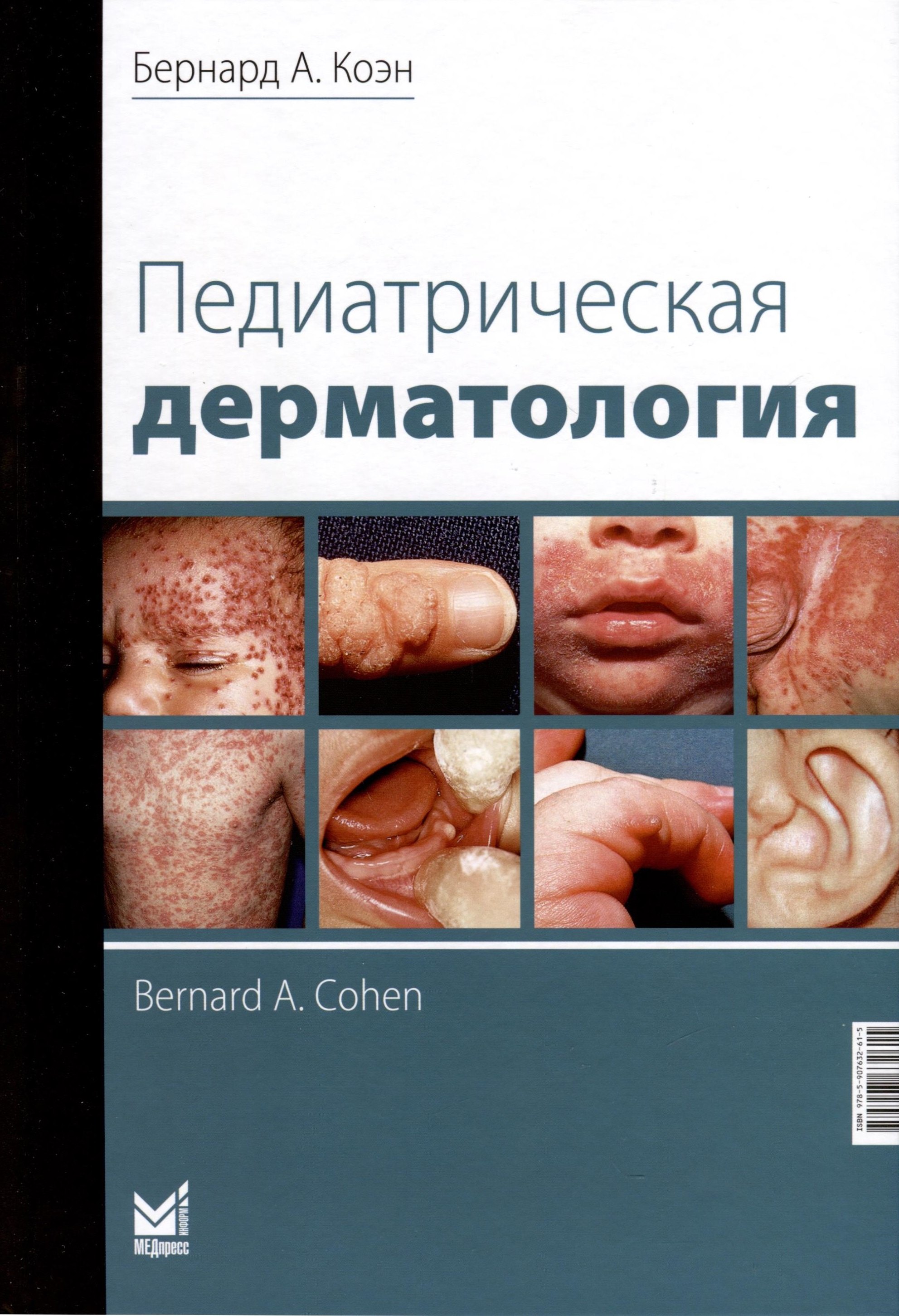 

Педиатрическая дерматология