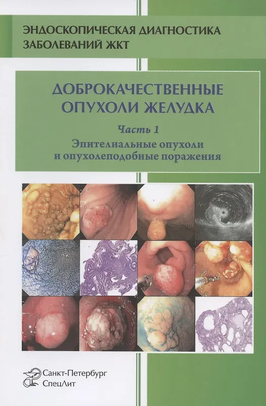 Книга Доброкачественные опухоли желудка. Эпителиальные опухоли и опухолеподобные поражения. Часть 1. Учебно-методическое пособие (Любовь Шкалова, Михаил Кузин, Вячеслав Радовский) — 1