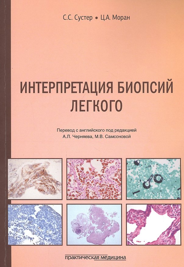 Книга Интерпретация биопсий легкого () — 1