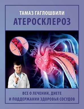 Атеросклероз. Все о лечении, диете и поддержании здоровья сосудов