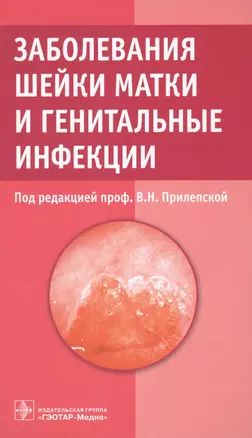 Заболевания шейки матки и генитальные инфекции. — 2518731 — 1