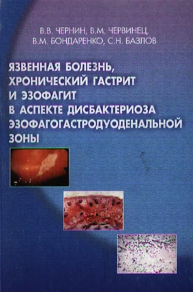 Книга Язвенная болезнь, хронический гастрит и эзофагит в аспекте дисбактериоза эзофагогастродуоденальной зоны (мягк). Чернин В. (Юрайт) () — 1