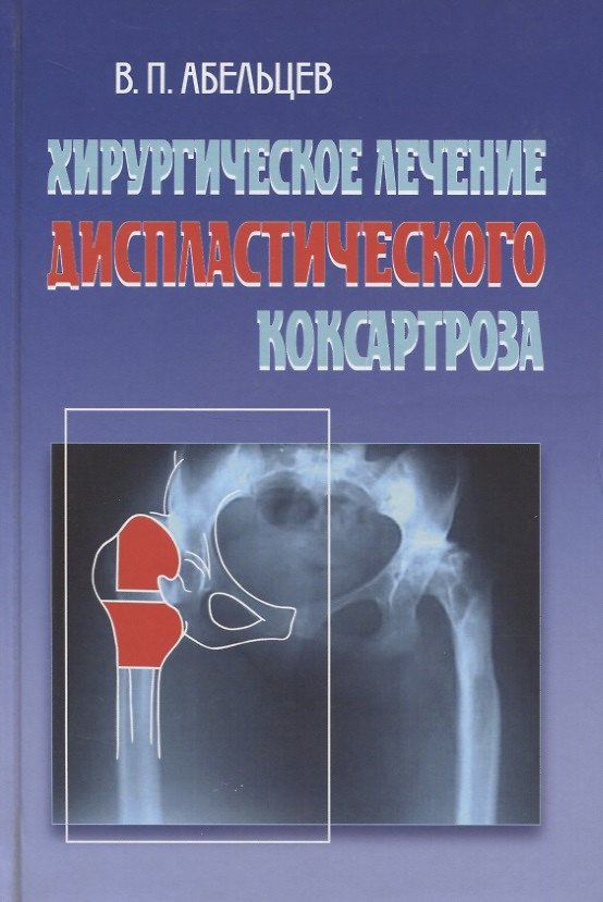 Книга Хирургическое лечение диспластического коксартроза (Владимир Абельцев) — 1