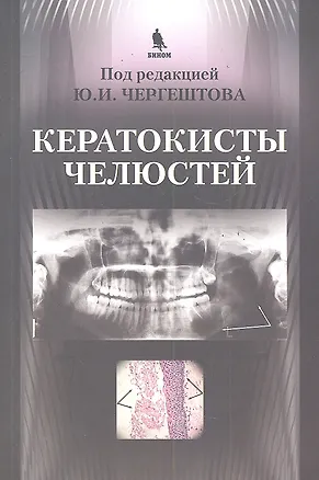Книга Кератокисты челюстей. ()