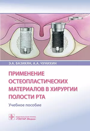 Применение остеопластических материалов в хирургии полости рта. Учебное пособие — 2704839 — 1