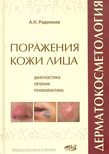 Дерматокосметология. Поражения кожи лица и слизистых. Диагностика, лечение и профилактика