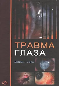 Травма глаза