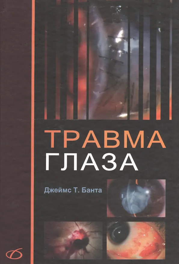 Книга Травма глаза (Д. Банта) — 1