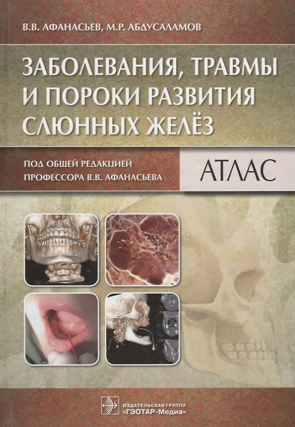 Книга Заболевания, травмы и пороки развития слюнных желёз (Василий Афанасьев) — 1