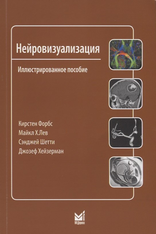 Книга Нейровизуализация (Кирстен Форбс) — 1