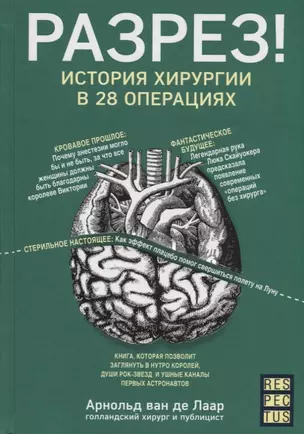 Разрез! История хирургии в 28 операциях — 2699423 — 1