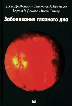 Заболевания глазного дна — 3027398 — 1