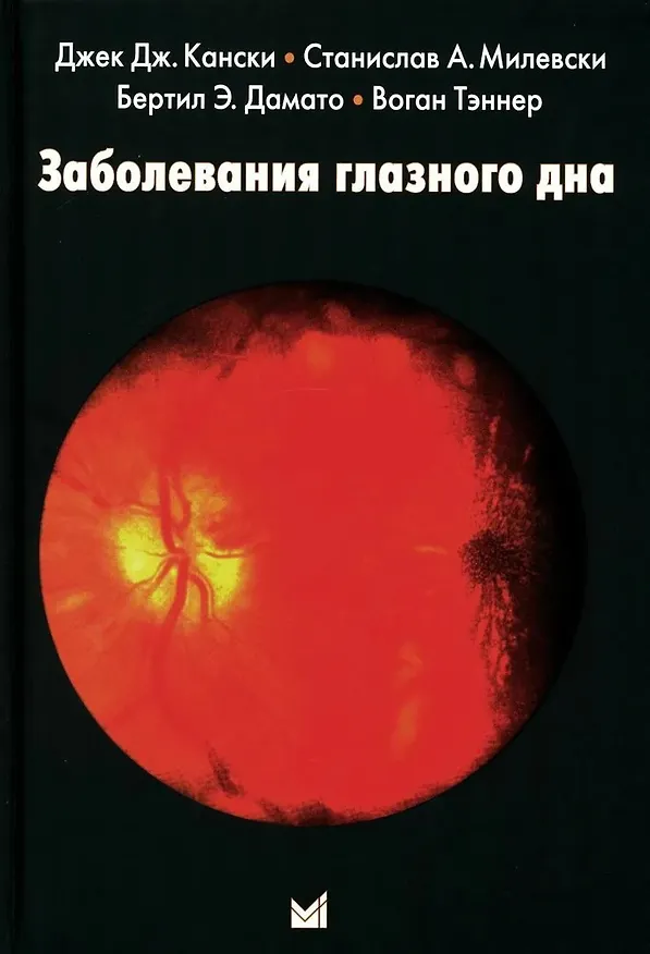 Книга Заболевания глазного дна (Джек Дж. Кански) — 1