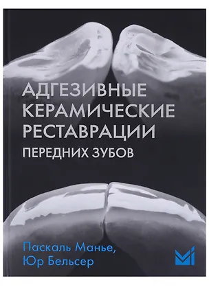 Книга Адгезивные керамические реставрации передних зубов (Паскаль Манье)