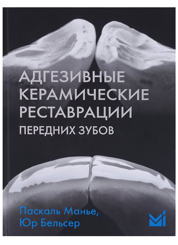 Книга Адгезивные керамические реставрации передних зубов (Паскаль Манье) — 1
