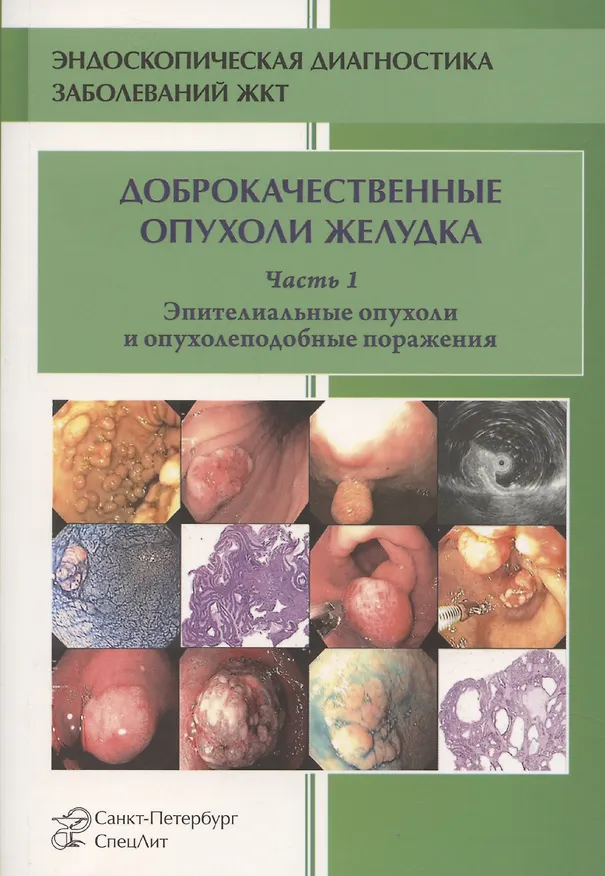 Книга Доброкачественные опухоли желудка. Часть 1. Эпителиальные опухоли и опухолеподобные поражения. Учебно-методическое пособие (Михаил Кузин) — 1