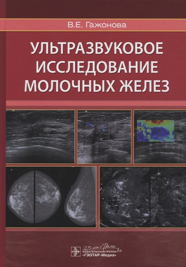 Книга Ультразвуковое исследование молочных желез (Вероника Гажонова) — 1