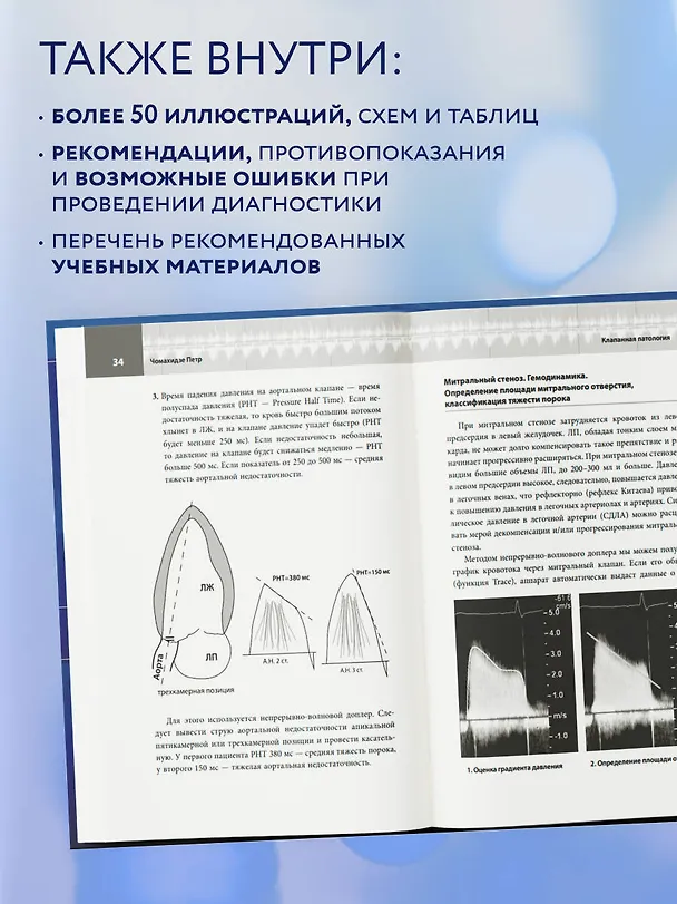 Книга Эхокардиография для начинающих. Суть гемодинамических нарушений, позиции для анализа, определение тяжести порока. 2-е издание, исправленное и дополненное (Петр Чомахидзе) — 7