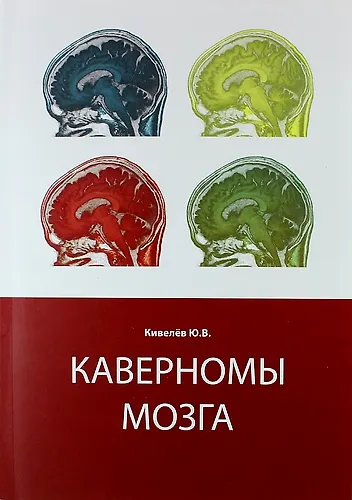 Книга Каверномы мозга (Юрий Кивелёв) — 1