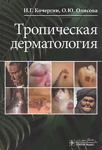 Тропическая дерматология