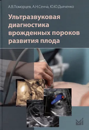 Книга Ультразвуковая диагностика врожденных пороков развития плода (Александр Сенча, Алексей Поморцев, Юлия Дьяченко)