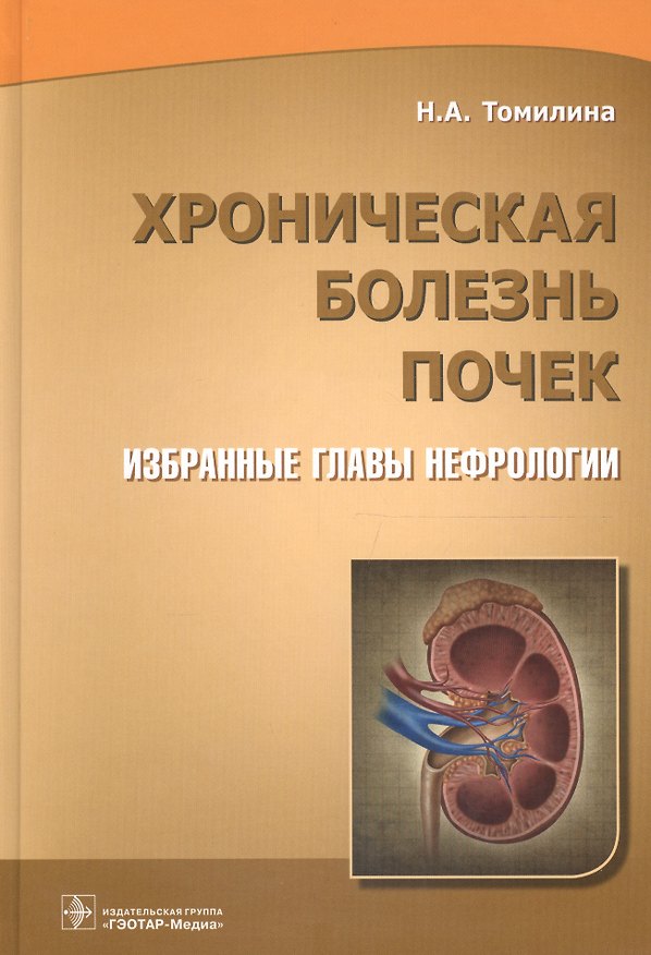Книга Хроническая болезнь почек Избранные главы нефрологии (Томилина) (Наталья Томилина) — 1
