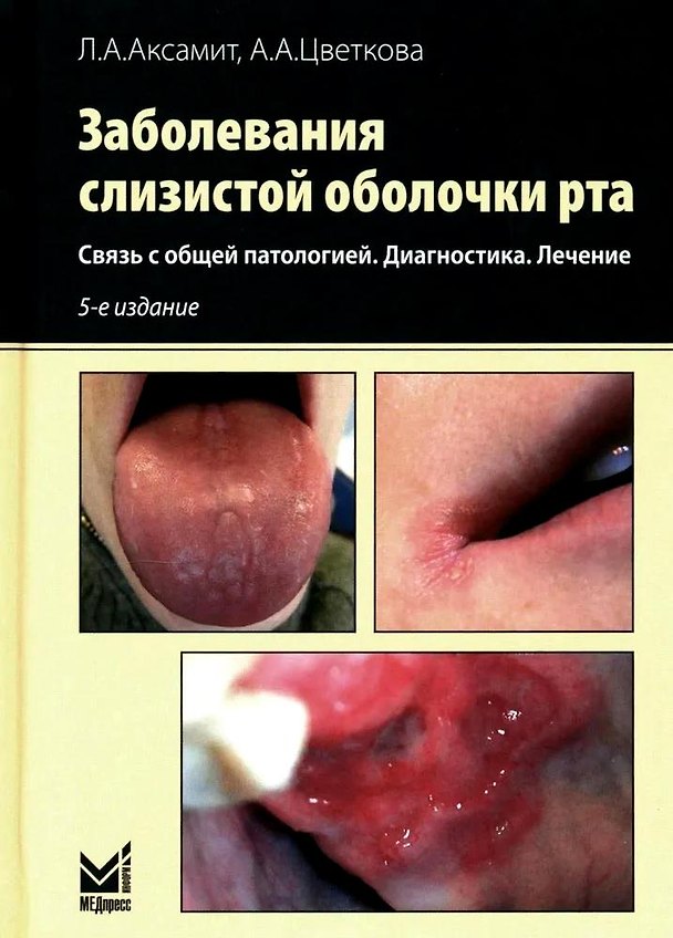 Книга Заболевания слизистой оболочки рта. Связь с общей патологией. Диагностика. Лечение (Александра Цветкова, Людмила Аксамит) — 1