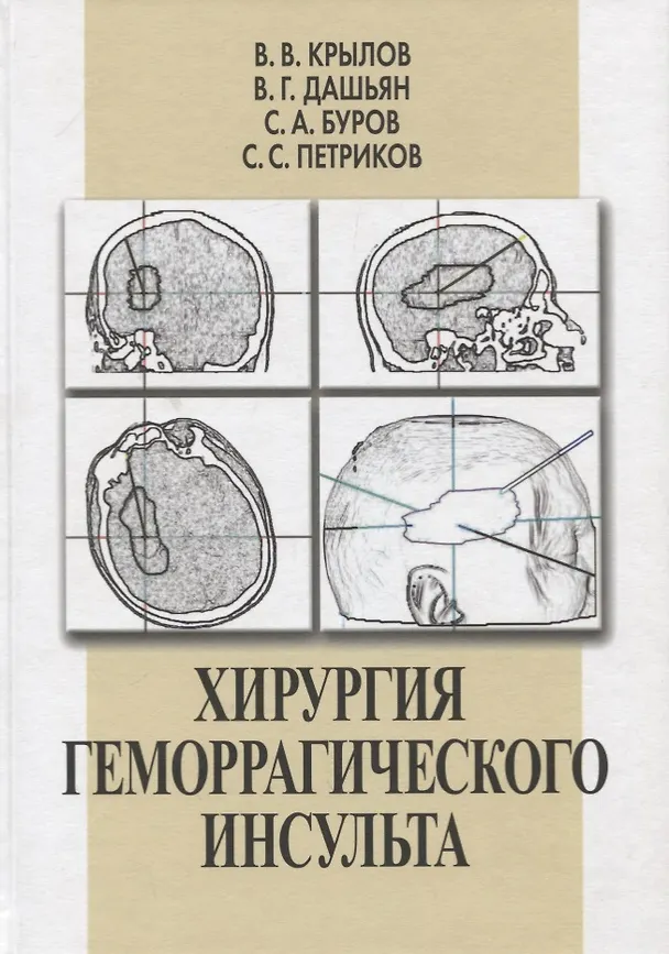 Книга Хирургия геморрагического инсульта () — 1