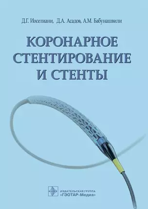 Коронарное стентирование и стенты — 2704833 — 1