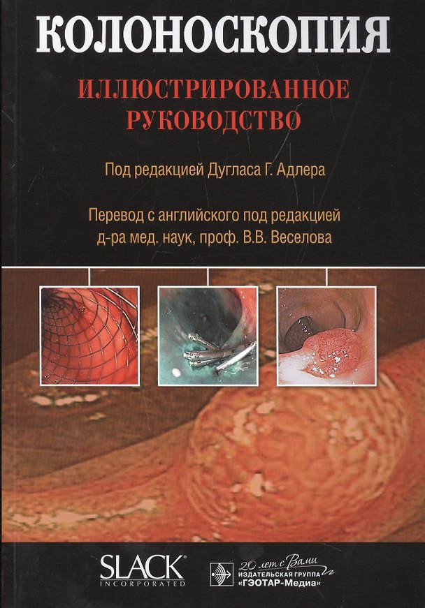 Книга Колоноскопия (Дуглас Г. Адлер) — 1