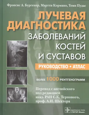 Книга Лучевая диагностика Заболевание костей и суставов Рук-во Атлас (Бургенер) ()