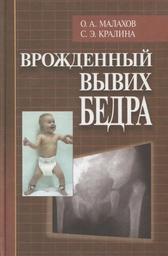 Книга Врожденный вывих бедра (клиническая картина, диагностика, консервативное лечение) () — 1