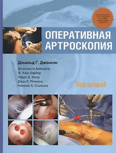 Оперативная артроскопия  т.2