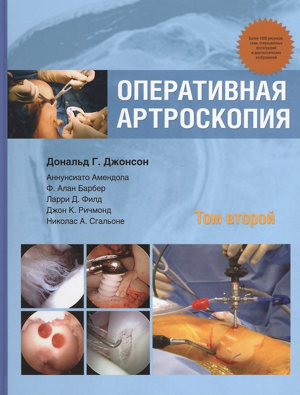 Книга Оперативная артроскопия т.2 (Дональд Г. Джонсон) — 1