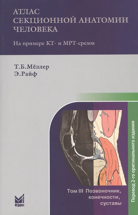 Книга Атлас секционной анатомии человека на примере КТ- и МРТ-срезов. В 3-х томах. Том 3. Позвоночник, конечности, суставы (Торстен Б. Меллер) — 1