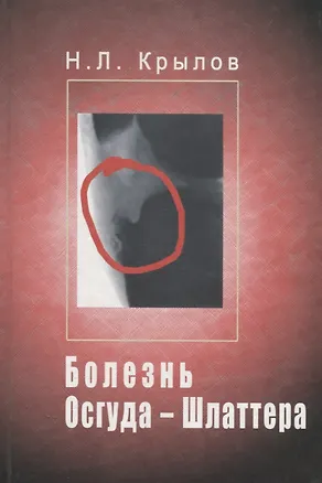 Книга Болезнь Осгуда - Шлаттера ()