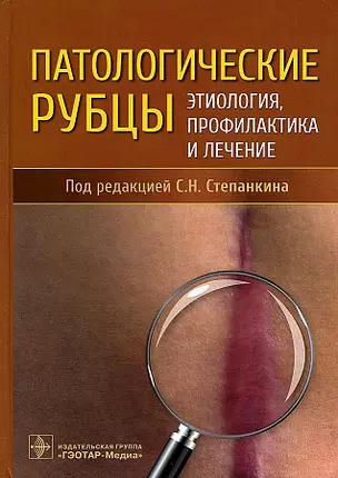 Патологические рубцы. Этиология, профилактика и лечение — 2910127 — 1