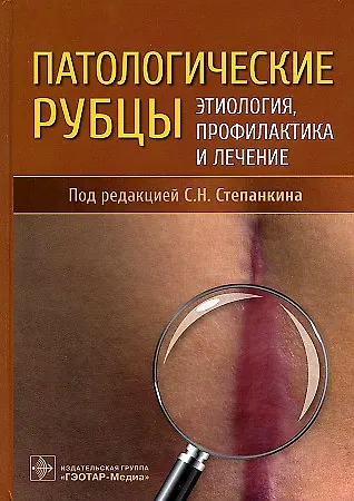 Книга Патологические рубцы. Этиология, профилактика и лечение (Сергей Степанкин) — 1